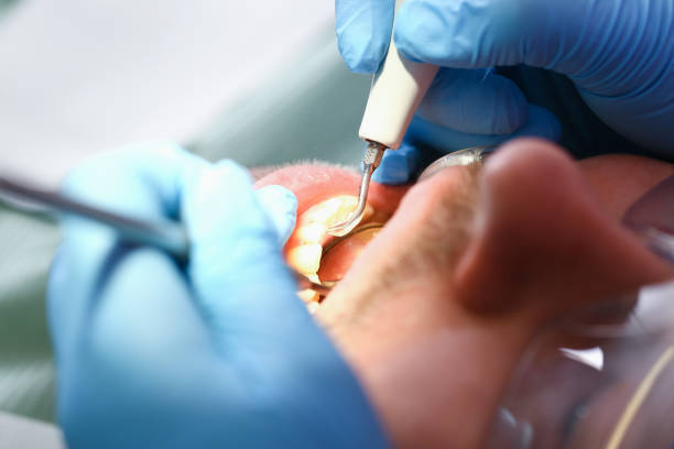 Best Cracked Tooth Emergency Dentist  in Berea, OH
